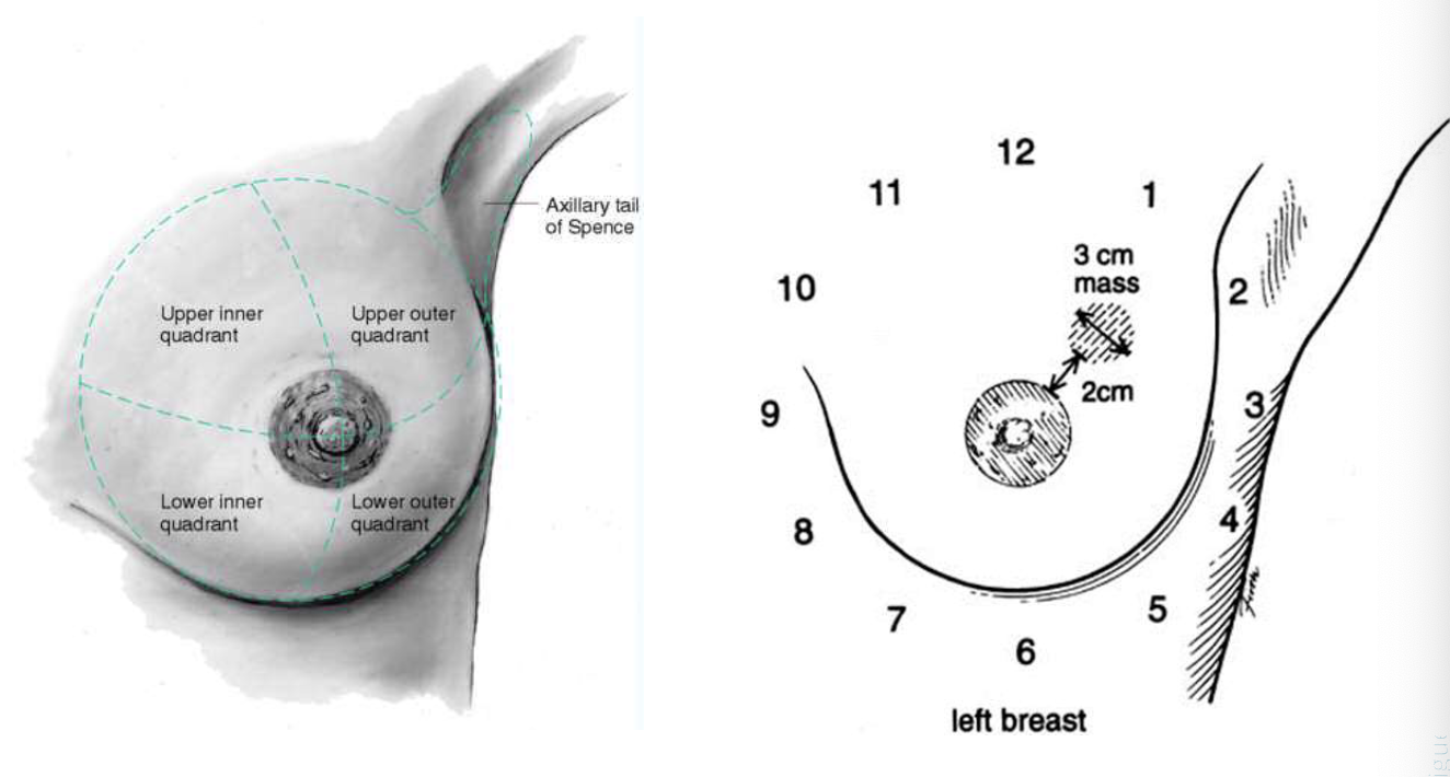 <p>Clock and Quadrants </p><ul><li><p>upper inner quadrant </p></li><li><p>upper outer quadrant</p></li><li><p>lower inner quadrant </p></li><li><p>lower outer quadrant </p></li><li><p>axillary tail of Spence </p></li></ul><p></p>
