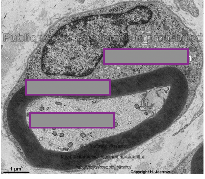 <p>Quels sont les trous ?</p>