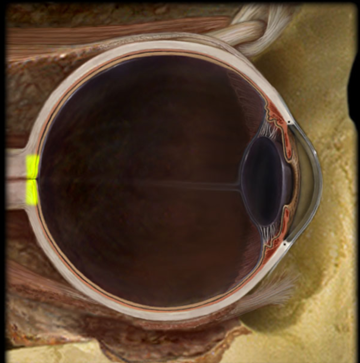<h4 collapsed="false" seolevelmigrated="true"><strong>Location:</strong></h4><ul><li><p>Retina</p></li><li><p>At junction with optic nerve</p></li></ul><h4 collapsed="false" seolevelmigrated="true"><strong>Description:</strong></h4><ul><li><p>Circular to oval area</p></li><li><p>Composed of optic fibers (axons of retinal ganglion cells) that form optic nerve</p></li><li><p>Central retinal artery enters eye through optic disk</p></li></ul><h4 collapsed="false" seolevelmigrated="true"><strong>Comment:</strong></h4><ul><li><p>Lack of photoreceptors in disk creates “blind spot” in visual field</p></li></ul>