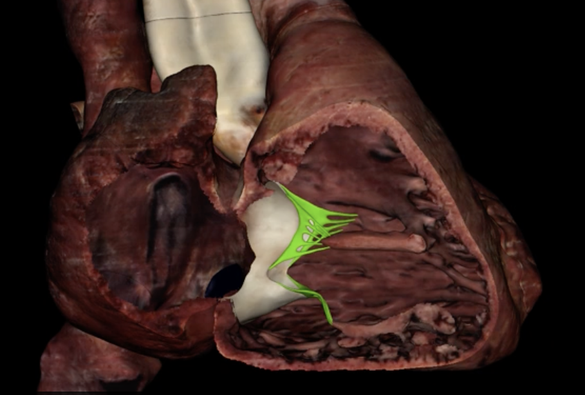 <p>What is highlighted in green?</p>