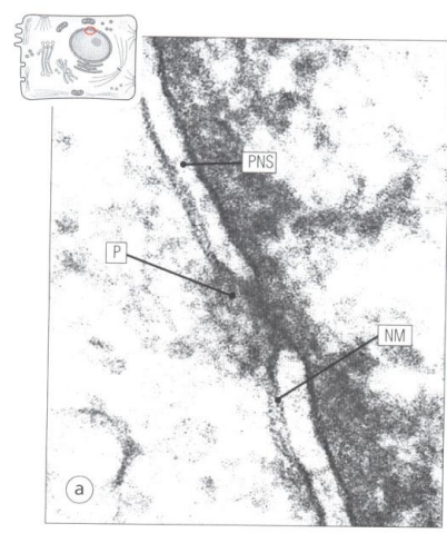 <p>What is NM and P?</p>