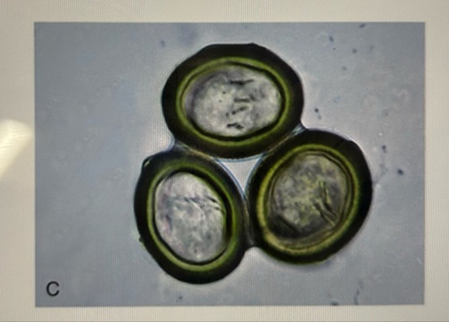 <p>These Cestode ova have a wide outer shell with a thicker outer covering and each ovum has a 6-headed hexacanth within the egg. This Cestode type of ovum is called..</p>