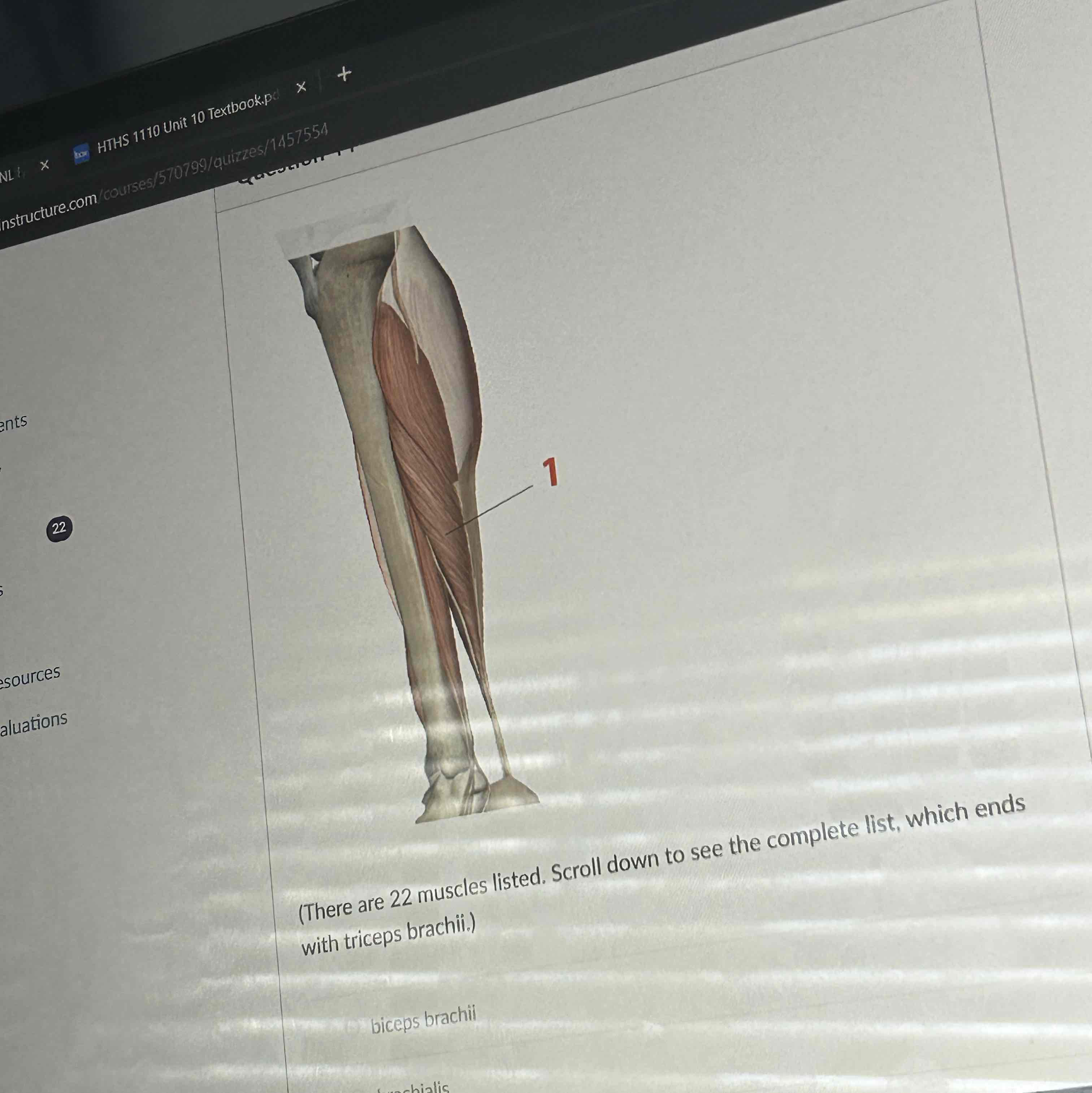 <p>The muscle at 1 is </p>