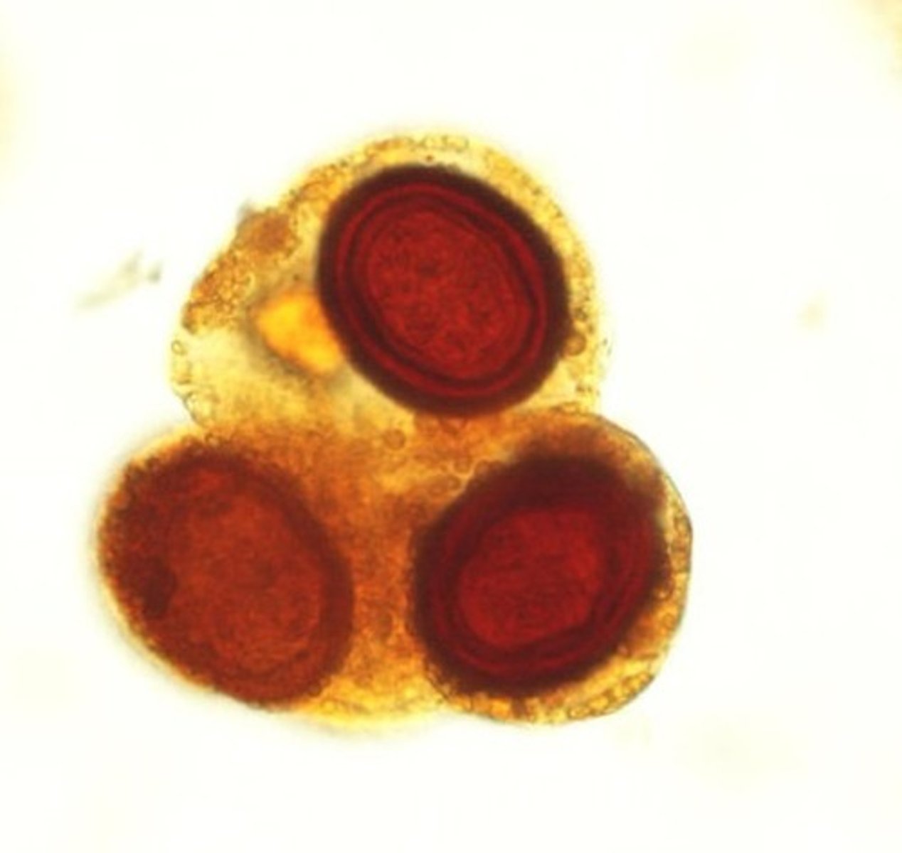 <p>Identify the parasite</p>