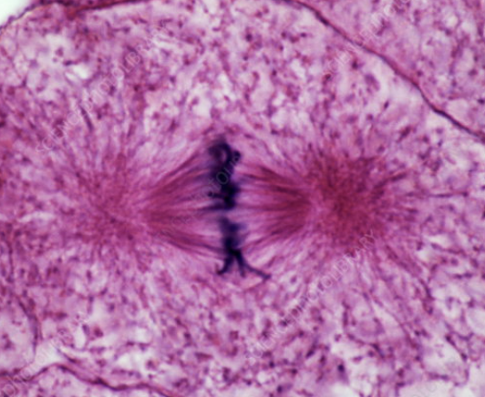 <p>Which phase of mitosis is this? Why is it important? </p>