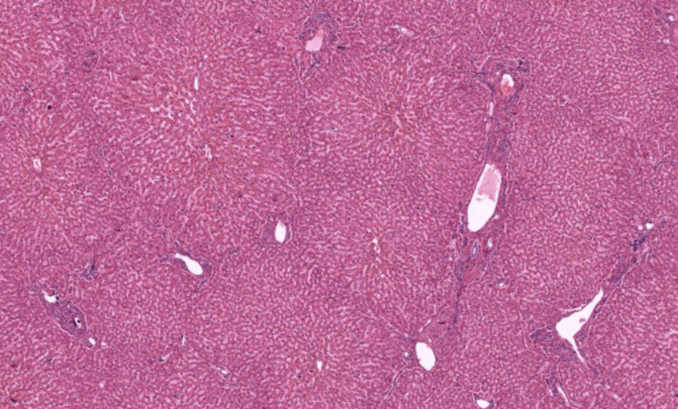 <p>Lobules in Liver</p>
