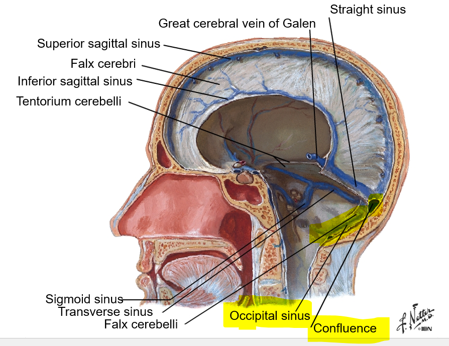 <p>in falx cerebelli; it drains posteriorly into the confluence </p>