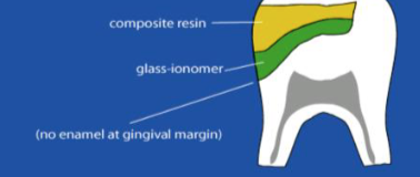 <p>what is this techniwue called </p>