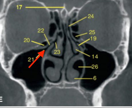 <p>identify the structure </p>