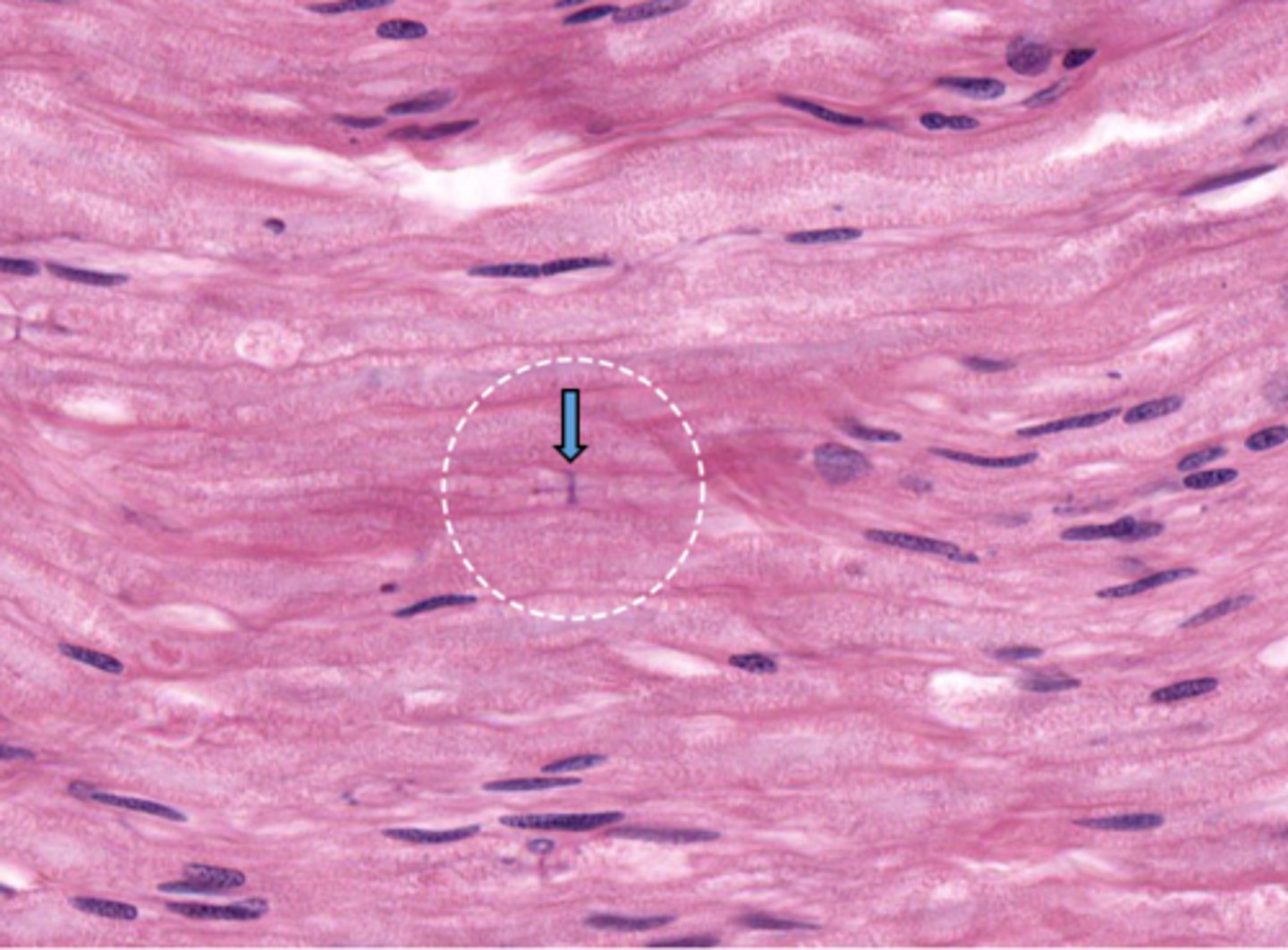 <p>The structure at the arrow represents the junction between adjacent cells of what type</p>