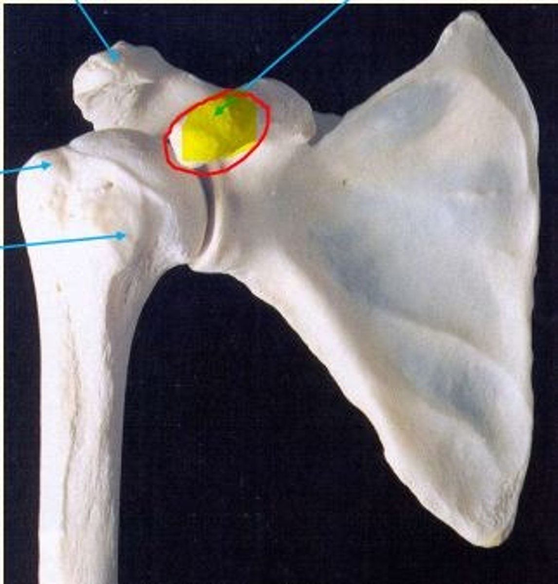 <p>Coracoid process</p><p>Palpable below the lateral clavicle</p>
