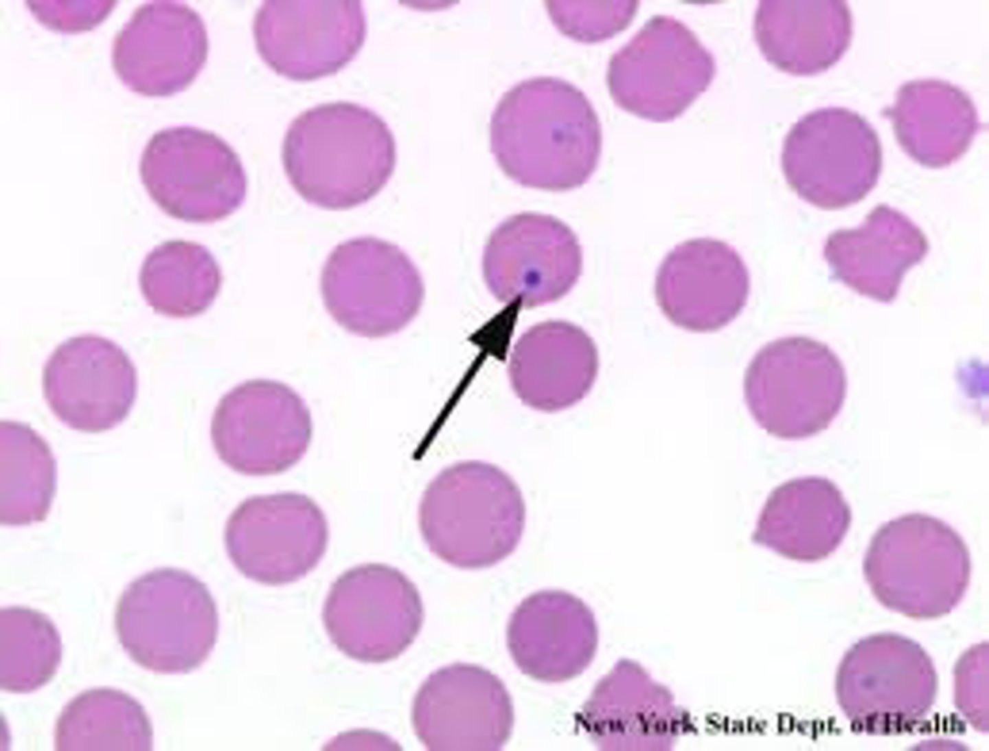 <p>Basophilic nuclear remnants seen in young erythrocytes during the response to anemia. Increased numbers indicates spleen disorders</p>