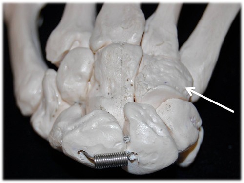 Name this carpal bone (posterior view).