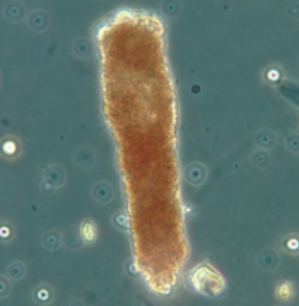 <p>what cast is this? What is it associated with?</p>