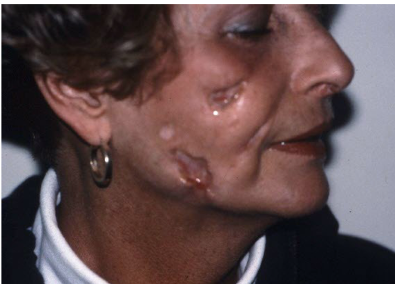 term image