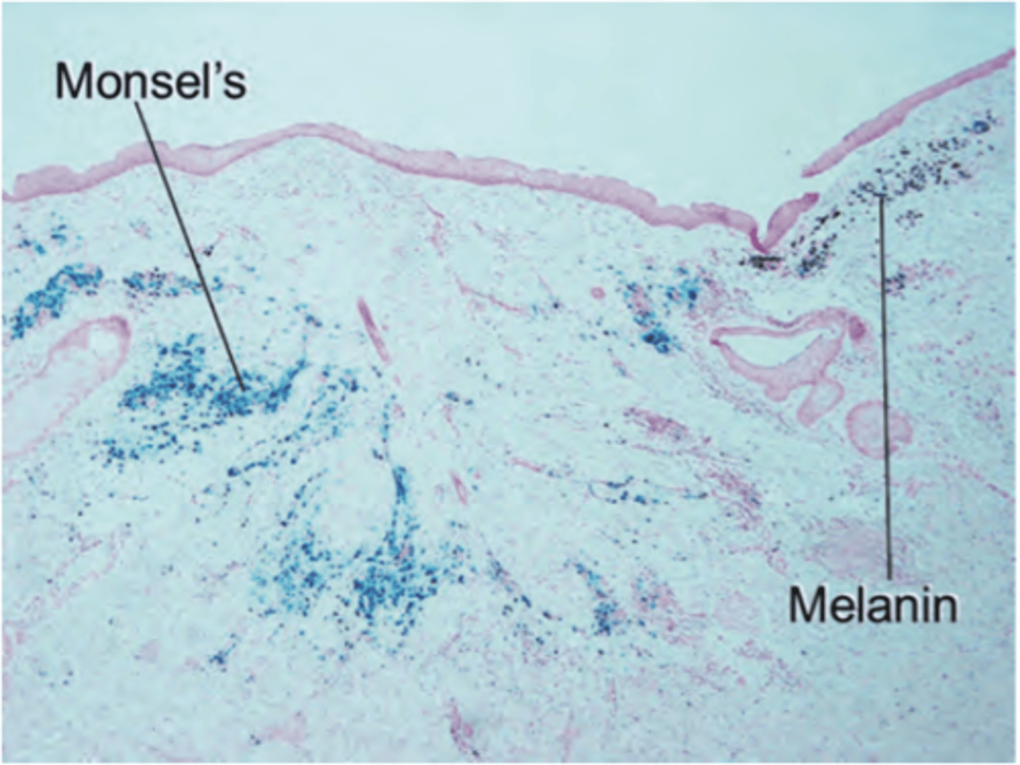 <p>iron</p><p>3 multiple choice options</p>