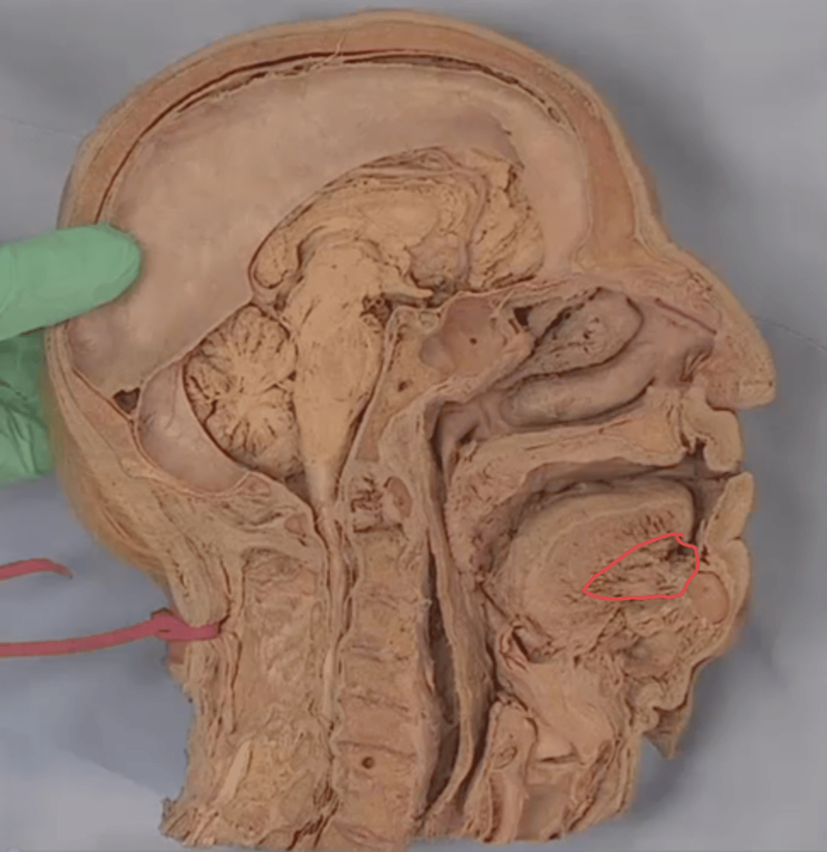 <p>identify this structure</p>