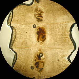 <p><span>A tapeworm scolex is shown below. Select the best description of a gravid proglottid of this species.</span></p><p>Barrel shape with double genital pores</p><p>Longer than wide, with less than 14 main<br>uterine branches per side</p><p>Longer than wide, with more than 14 main<br>uterine branches per side</p><p>Wider than long with a rosette-shaped uterus</p><p>None of the above</p>