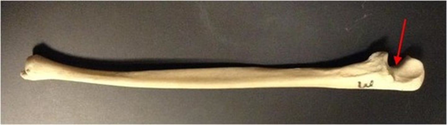 <p>ID structure/curve</p>