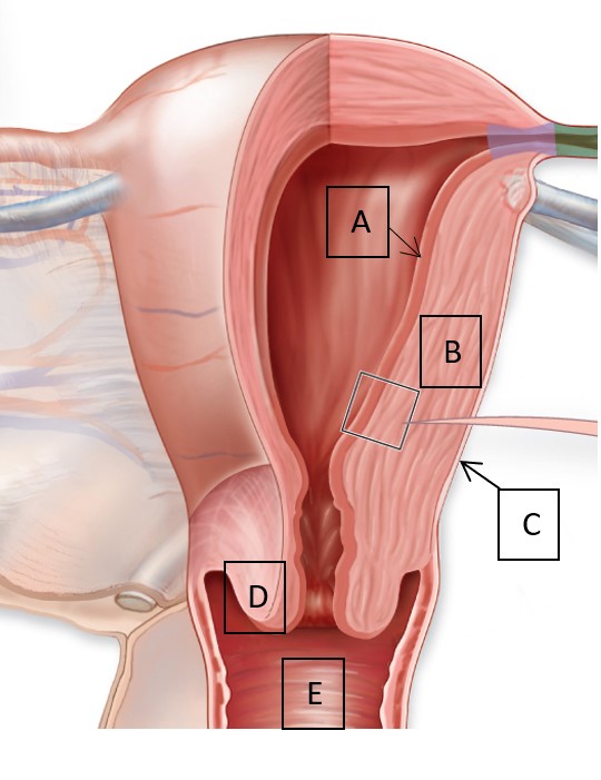 <p>Use the following image to match the letter to the description: </p><p><span>1. Is composed of uterine glands, a functional layer, and a basal layer.</span><br><span>2. Is composed of non-keratinized stratified squamous epithelium.</span><br><span>3. Identify the myometrium.</span></p>