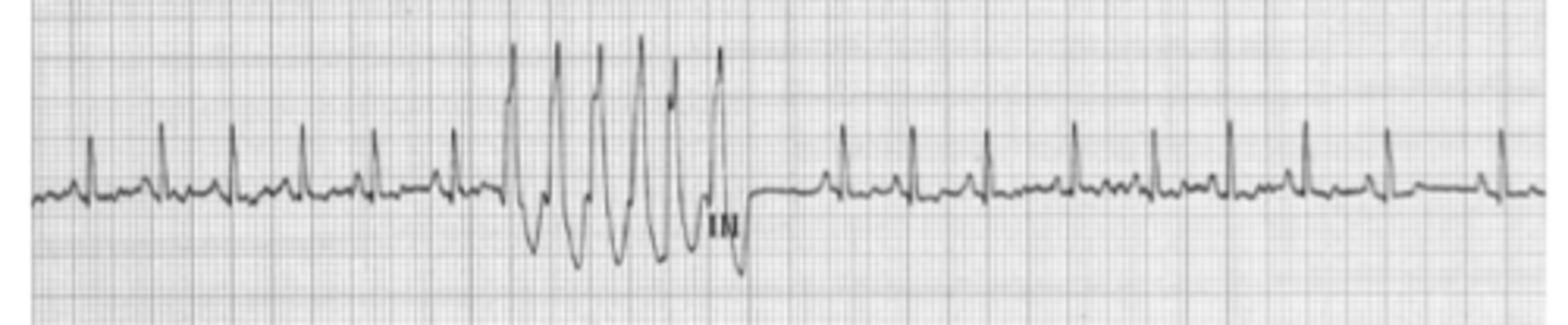 <p>Describe EKG</p>