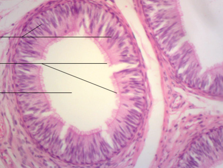 <p>Identify the organ in the micrograph</p>