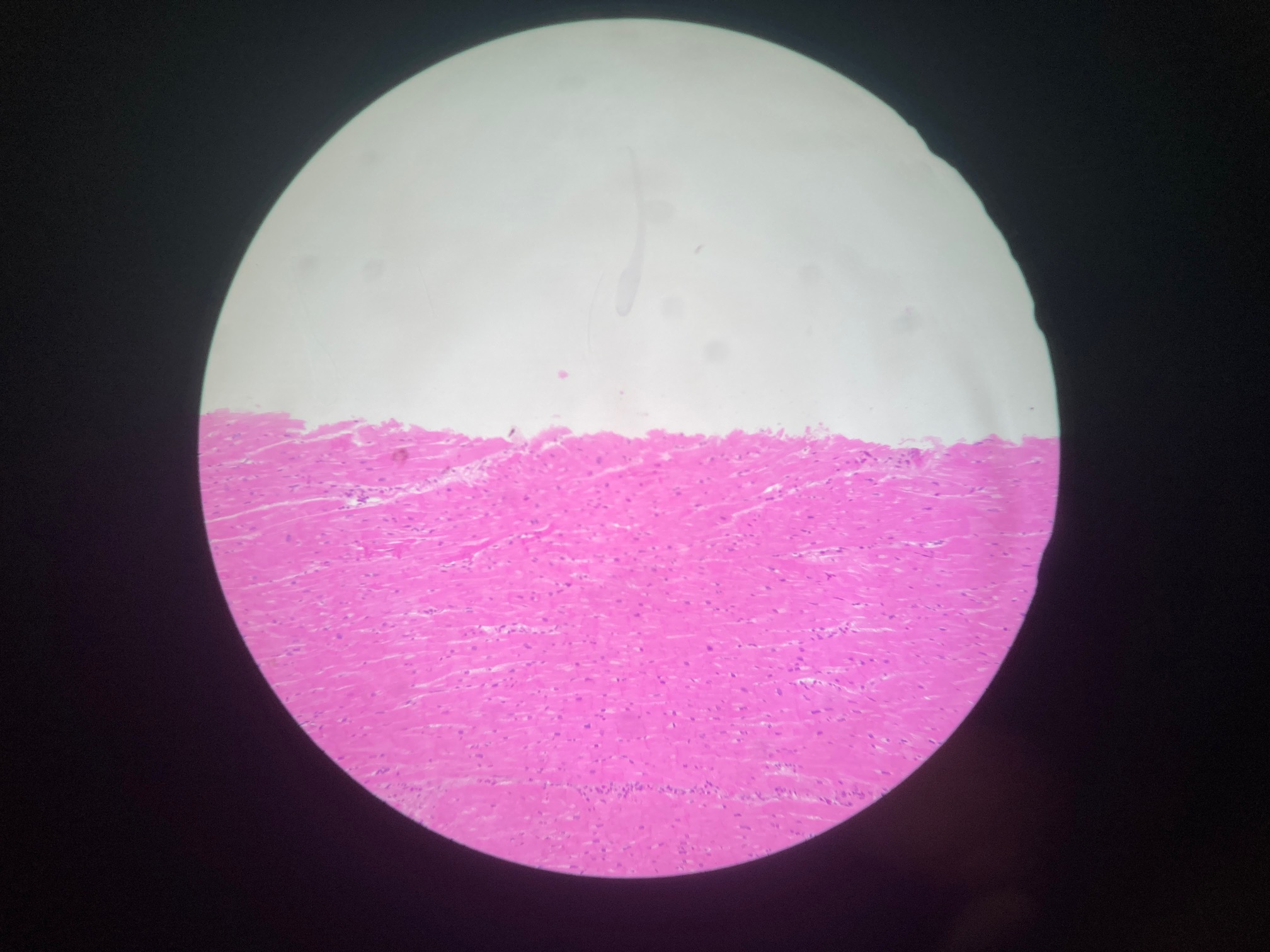 <p>Cardiac muscle</p><p>Pink Rectangle</p><p>Intercalated discs, centrally located nuclei</p>