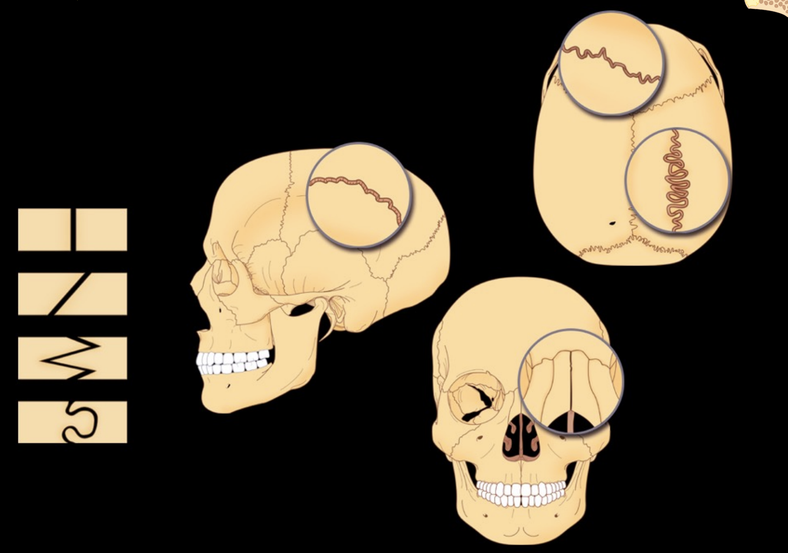 <p>What type of fibrous joint and subtype</p>
