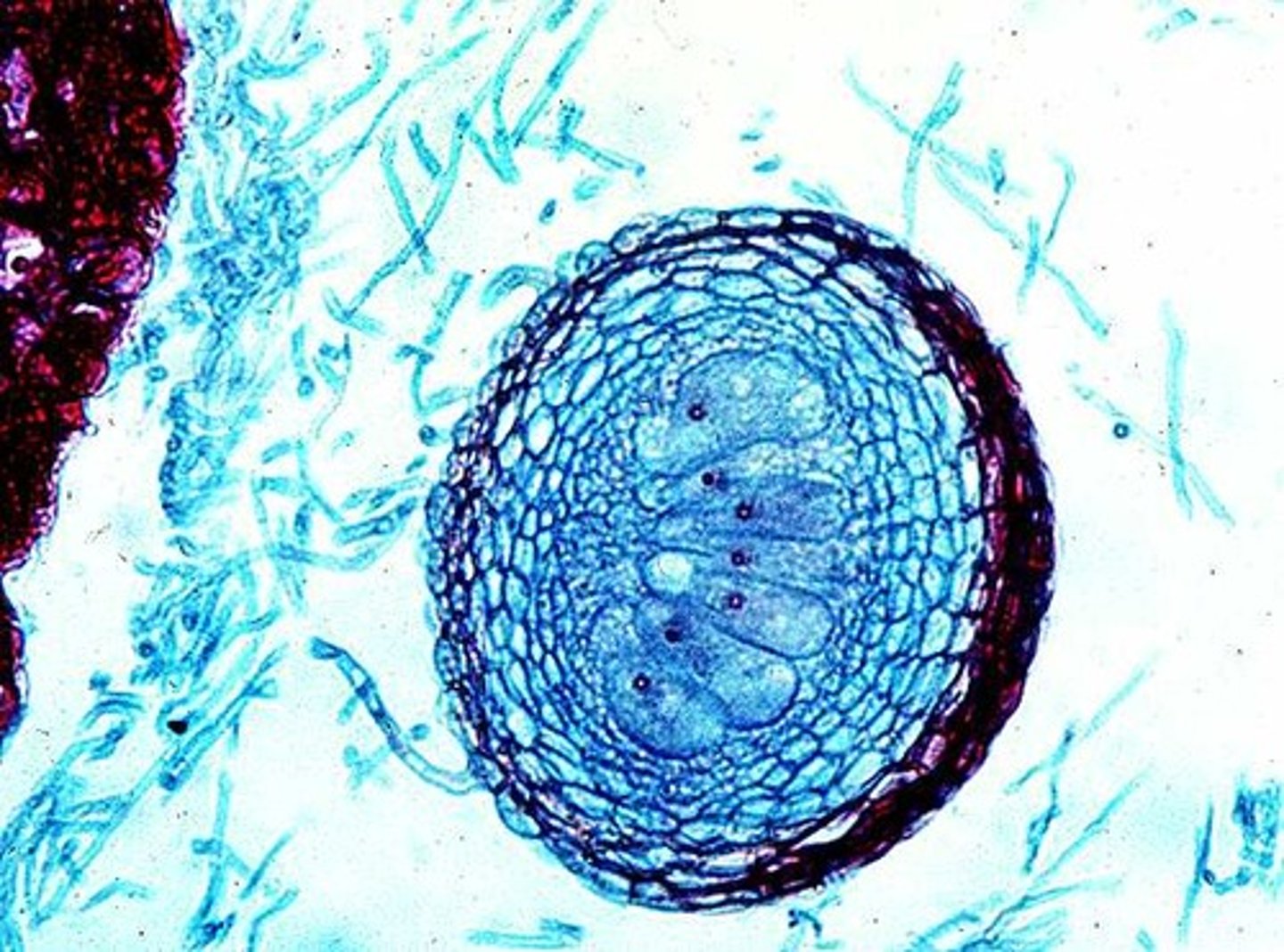 <p>associated with powdery mildew</p>