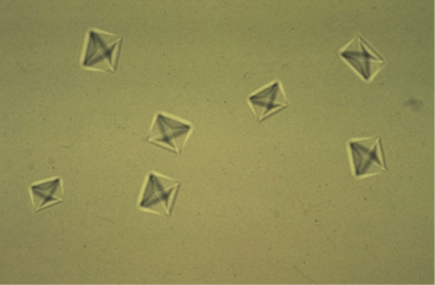 <p>Small squares with an X across the crystal resembling the back of an envelope; commonly seen in small dogs and horses</p>