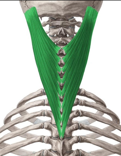 <p>Splenius capitis insertion</p>