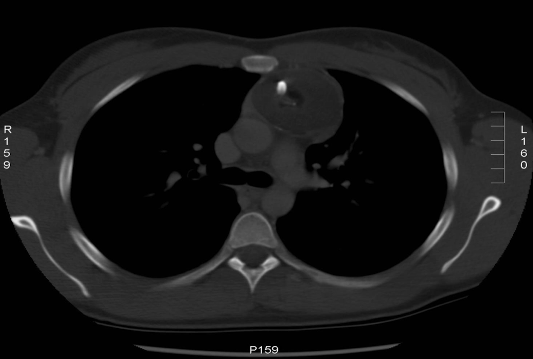 <p>Requested if pt has suffered any trauma or if looking for calcifications </p>