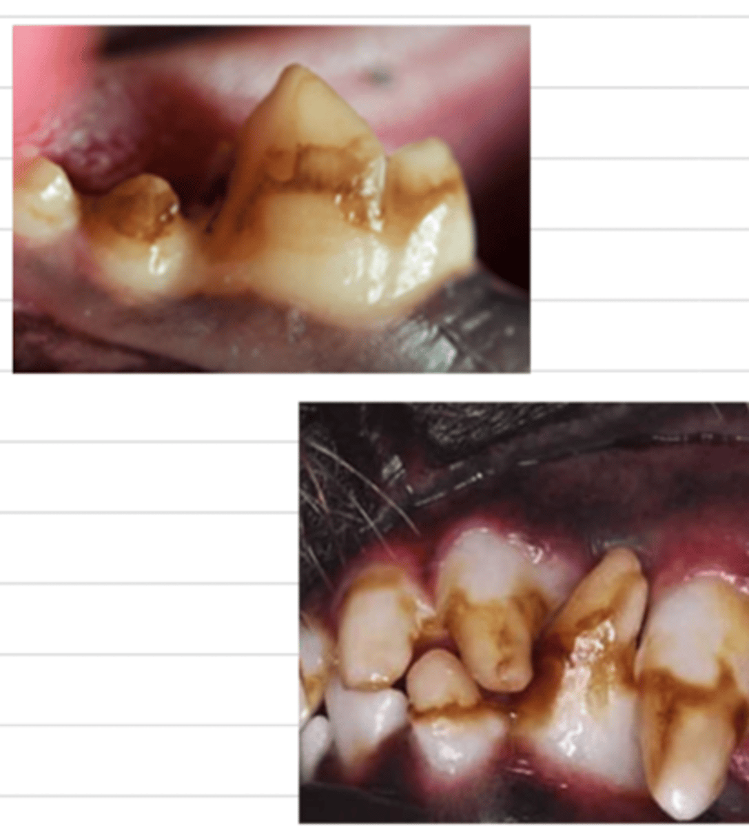 <p>these characteristic brown marks on the teeth indicate a problem with the ______, which can be caused by _____</p>