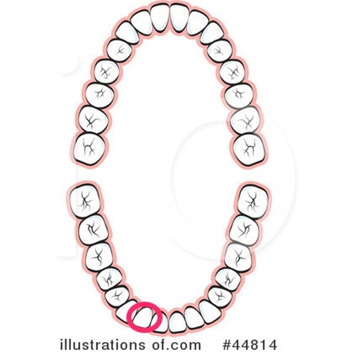 <p>LR lateral incisor</p>