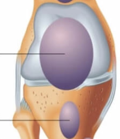 <p>Which type of synovial joint structure has:</p><ul><li><p>Pockets of synovial fluid</p></li><li><p>Cushion areas where tendons or ligaments rub</p></li><li><p>Reduces friction</p></li></ul><p></p>