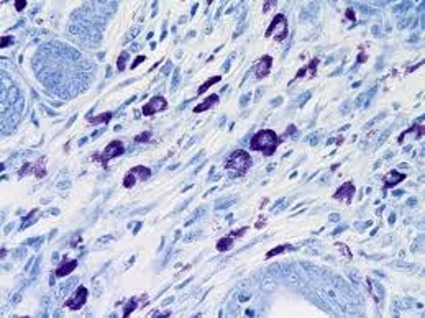 <p>Enhances nuclear detail. (differentiates WBCs and renal tubular epithelial cells (RTE))</p>