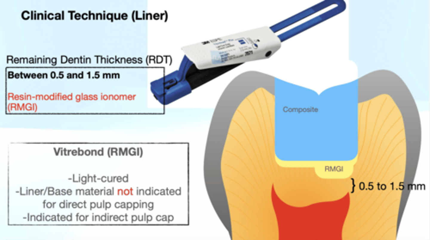 <p>Resin-Modified Glass Ionomer (RMGI)</p>