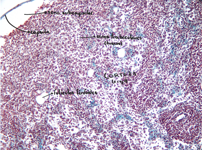 <p>Ganglio linfático</p>