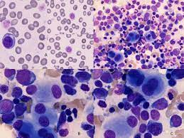 <p>hmmmmm…. (pluralis)</p>