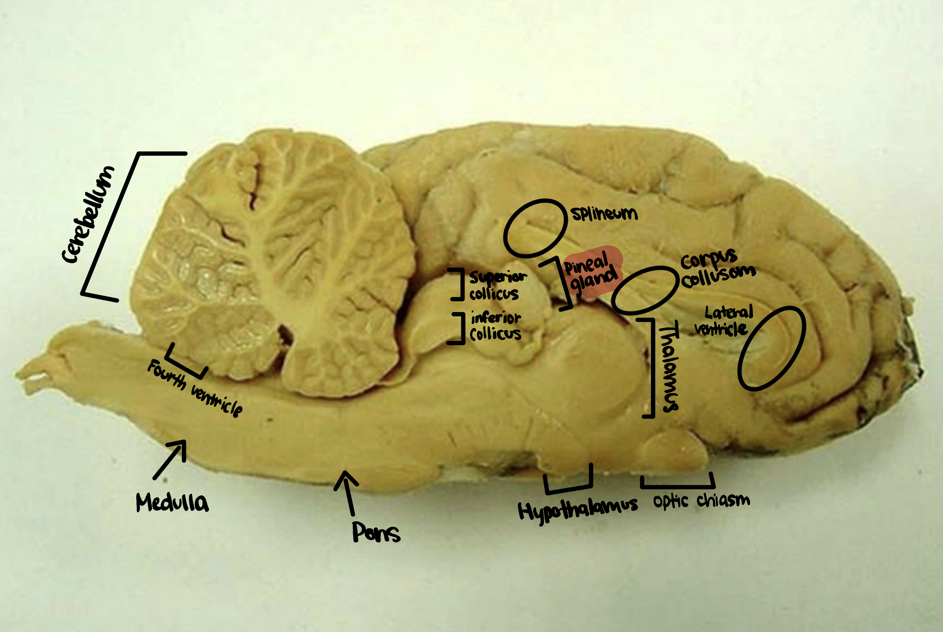 <p>Pineal Gland</p>
