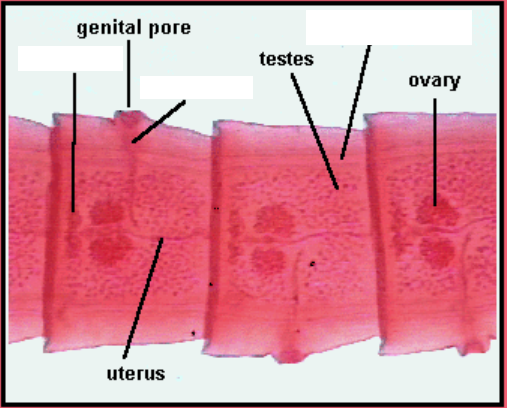 <p>Phylum Platyhelminthes. Class Cestoda. <em>Taenia</em>. </p>
