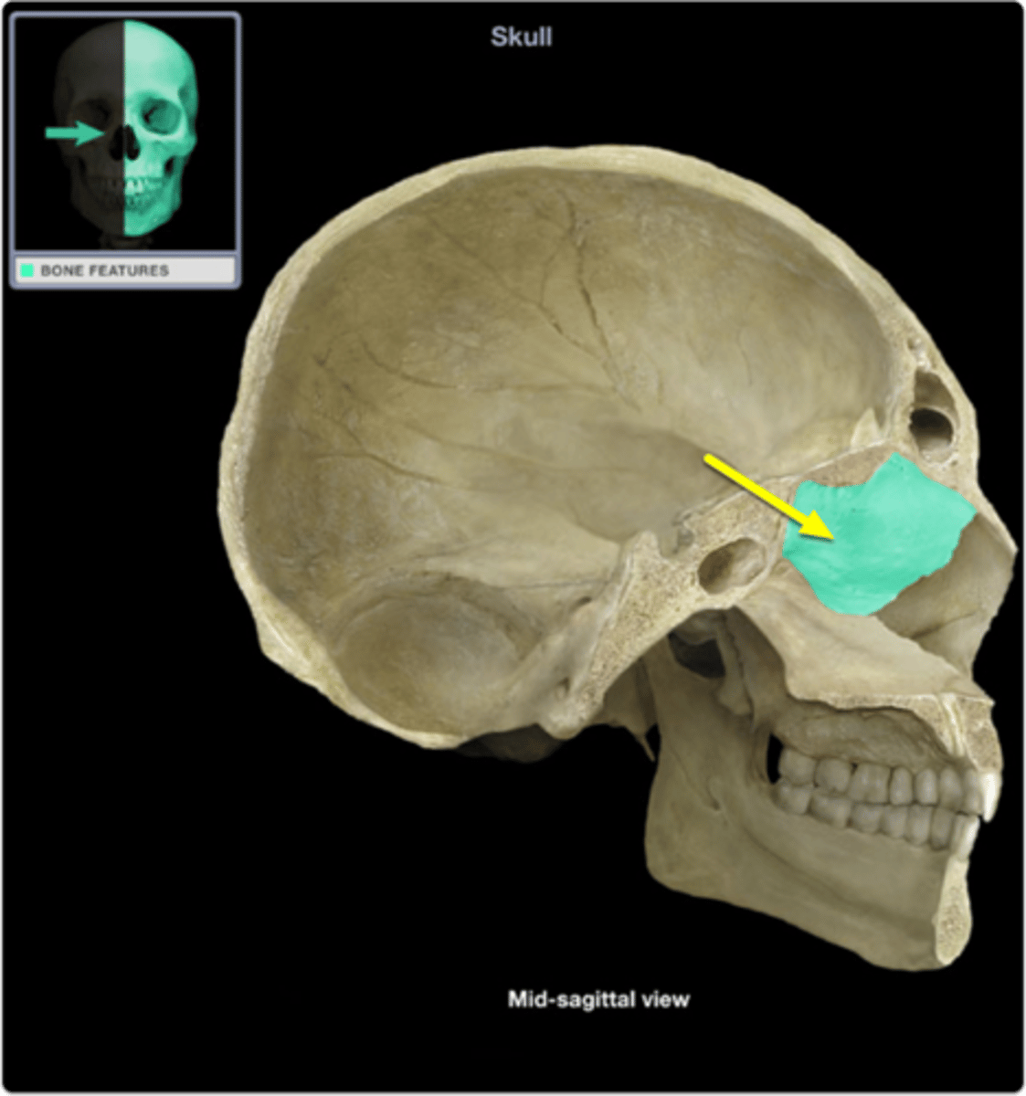 <p>median inferior projection of the ethmoid; forms superior nasal septum</p>