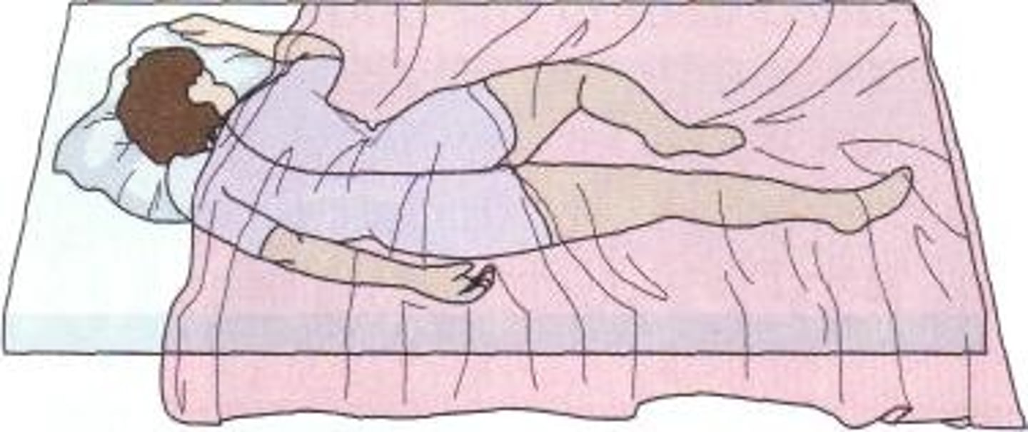 <p>lying on left side with right knee drawn up and with left arm drawn behind, parallel to the back</p>