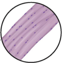 <p>Striated </p>