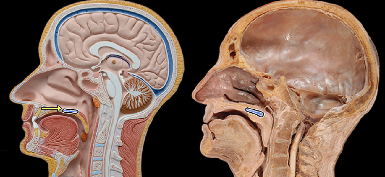 <p>Palatine bone</p>