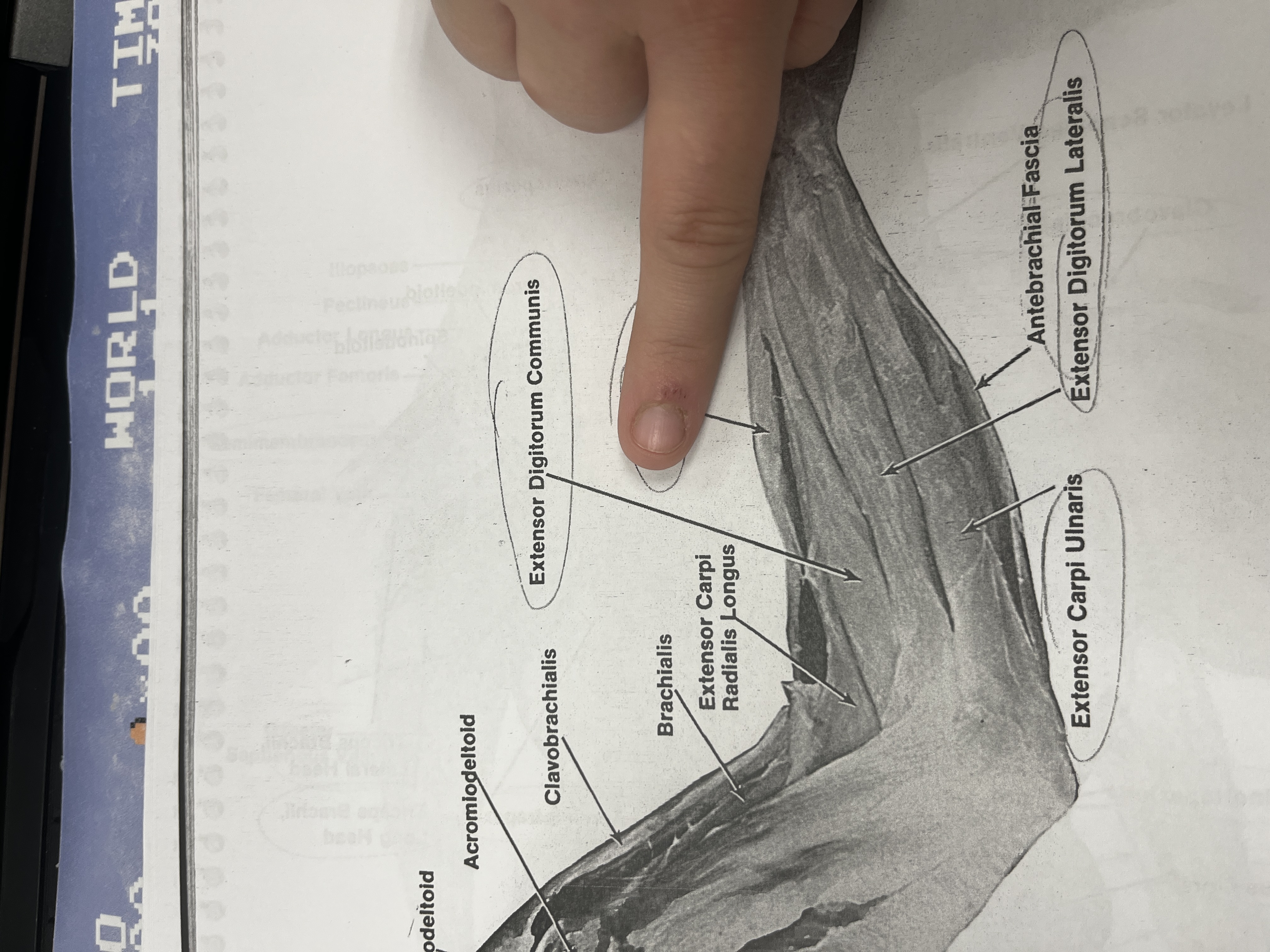 <p>A muscle of the forearm that flexes the forearm at the elbow.</p>