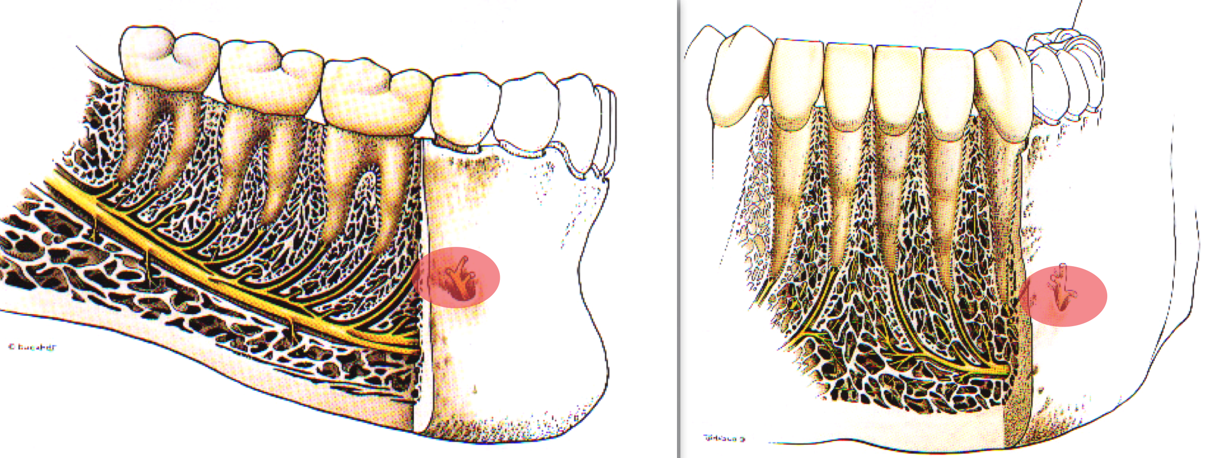 <p>Target Site: Mental nerve as it exits mental foramen (between apices of the 1st and 2nd premolar)</p><p>1 injection 1 technique mental and incisive soft tissue and anteriors</p>