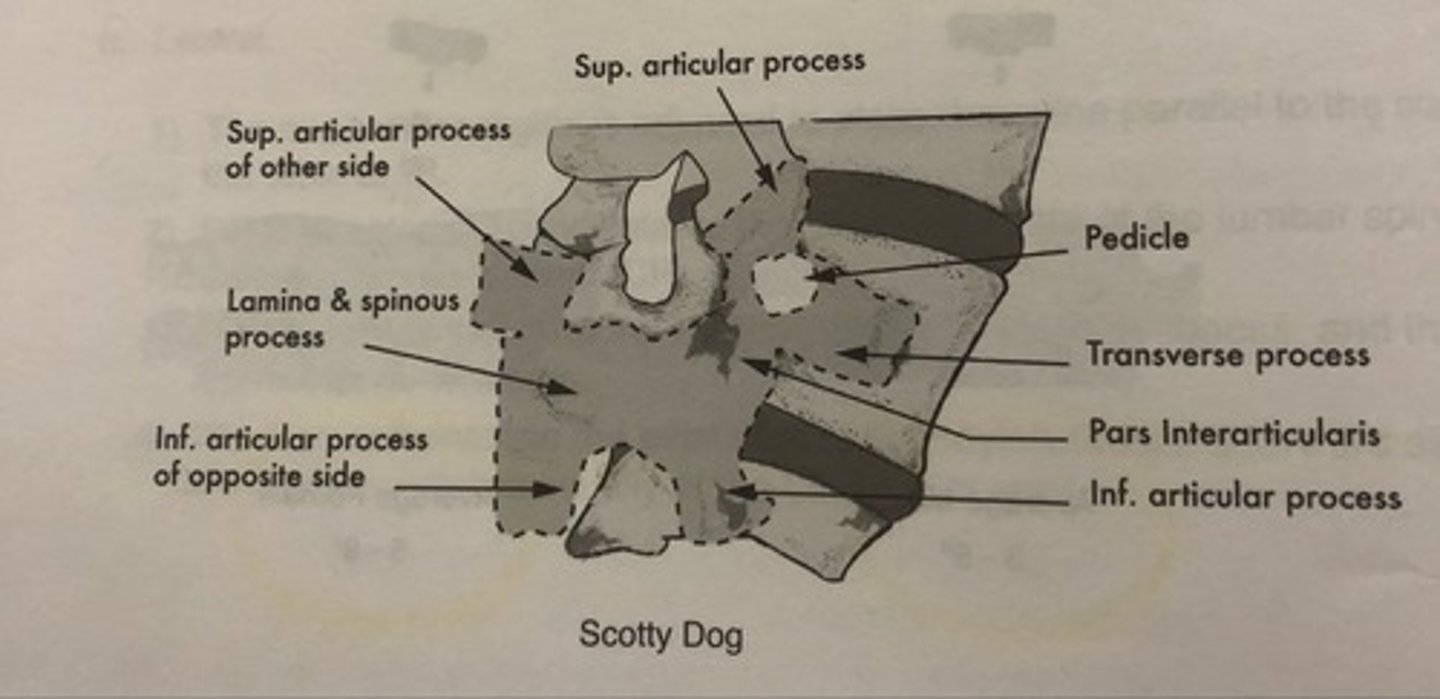 <p>superior articular process</p>