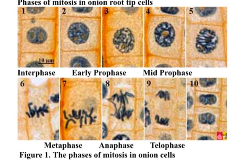 <p>Be able to recognize parts of PMAT in the onion root:</p>