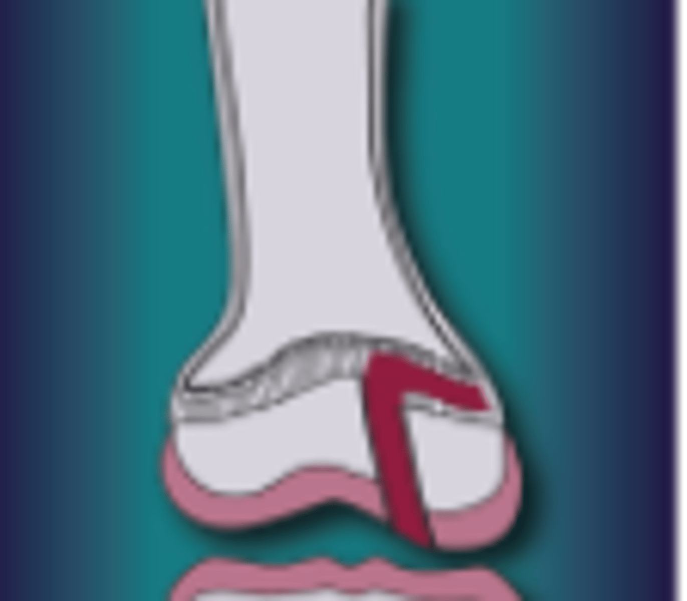 <p>What injury is this</p>